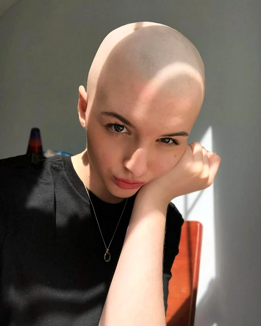 Наташа Уайтман лысая