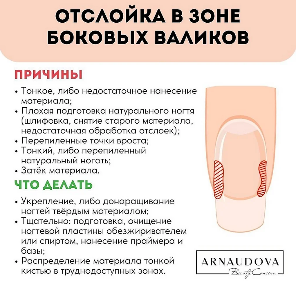 Отслойка нарощенных ногтей