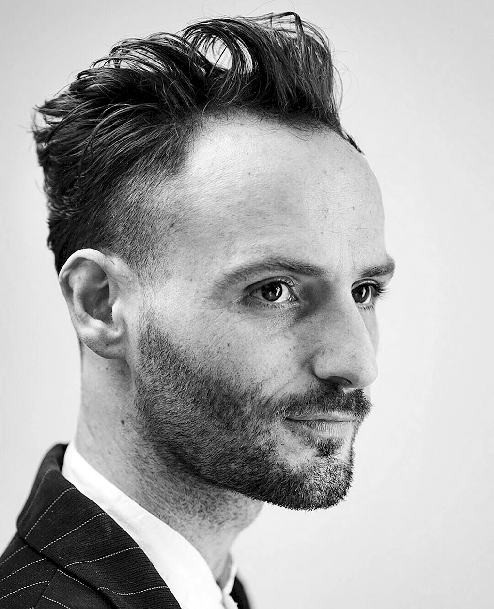 Receding Hairline